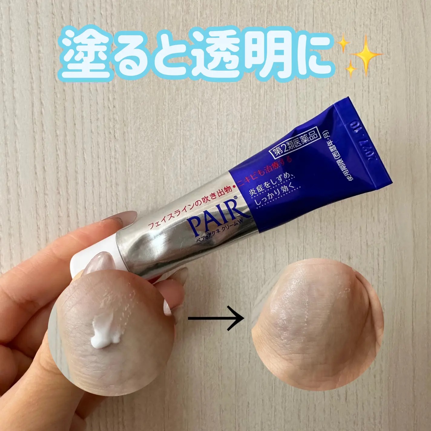 Kem trị mụn Pair Acne Cream W 24g của Nhật - Ảnh 4